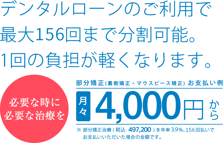 デンタルローンで分割払いもできます価格設定