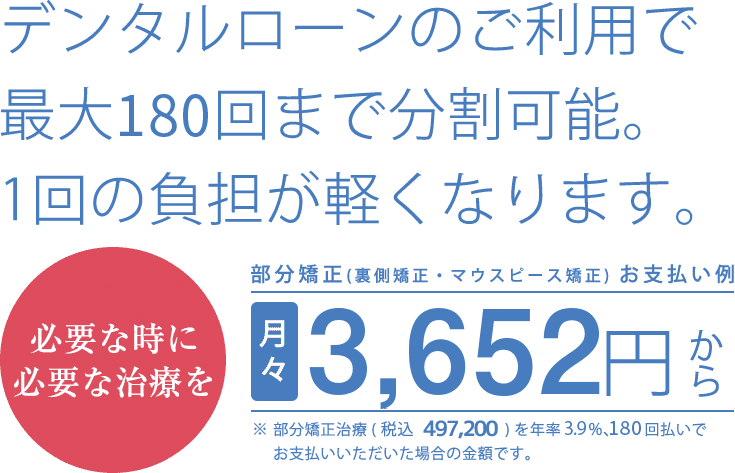 デンタルローンで分割払いもできます価格設定