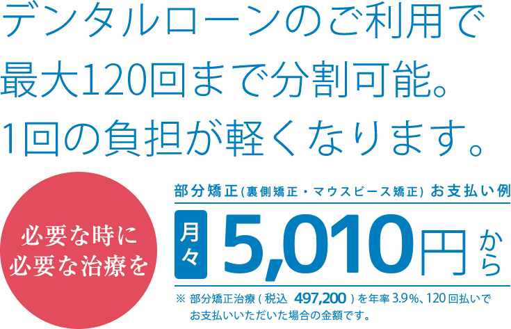 デンタルローンで分割払いもできます価格設定