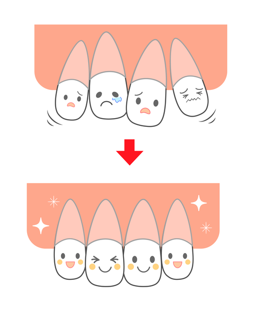 歯が動く　矯正期間　歯科矯正