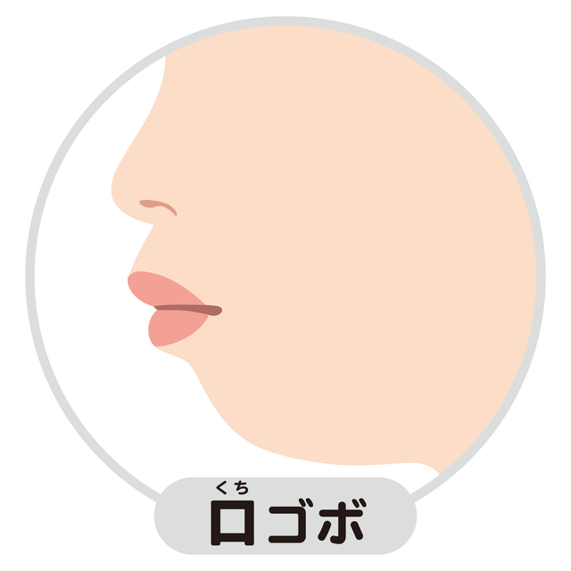 口元　変化　口ゴボ