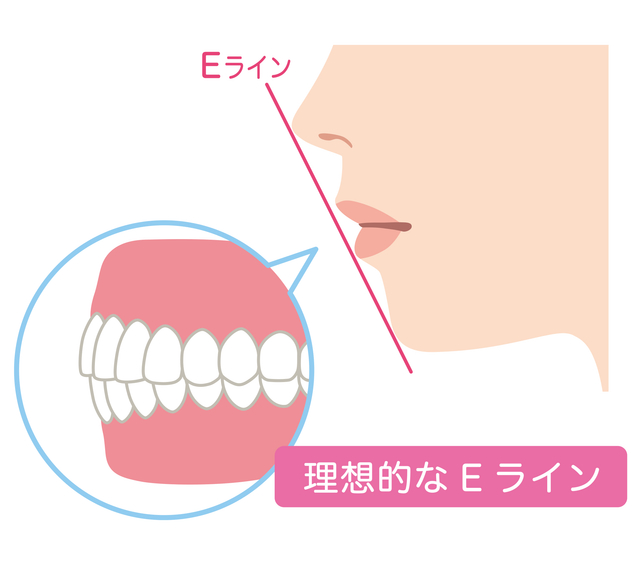 横顔　改善　Eライン