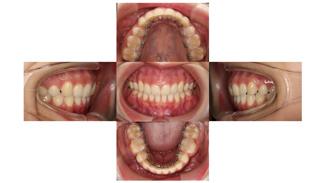 ２年６か月経過