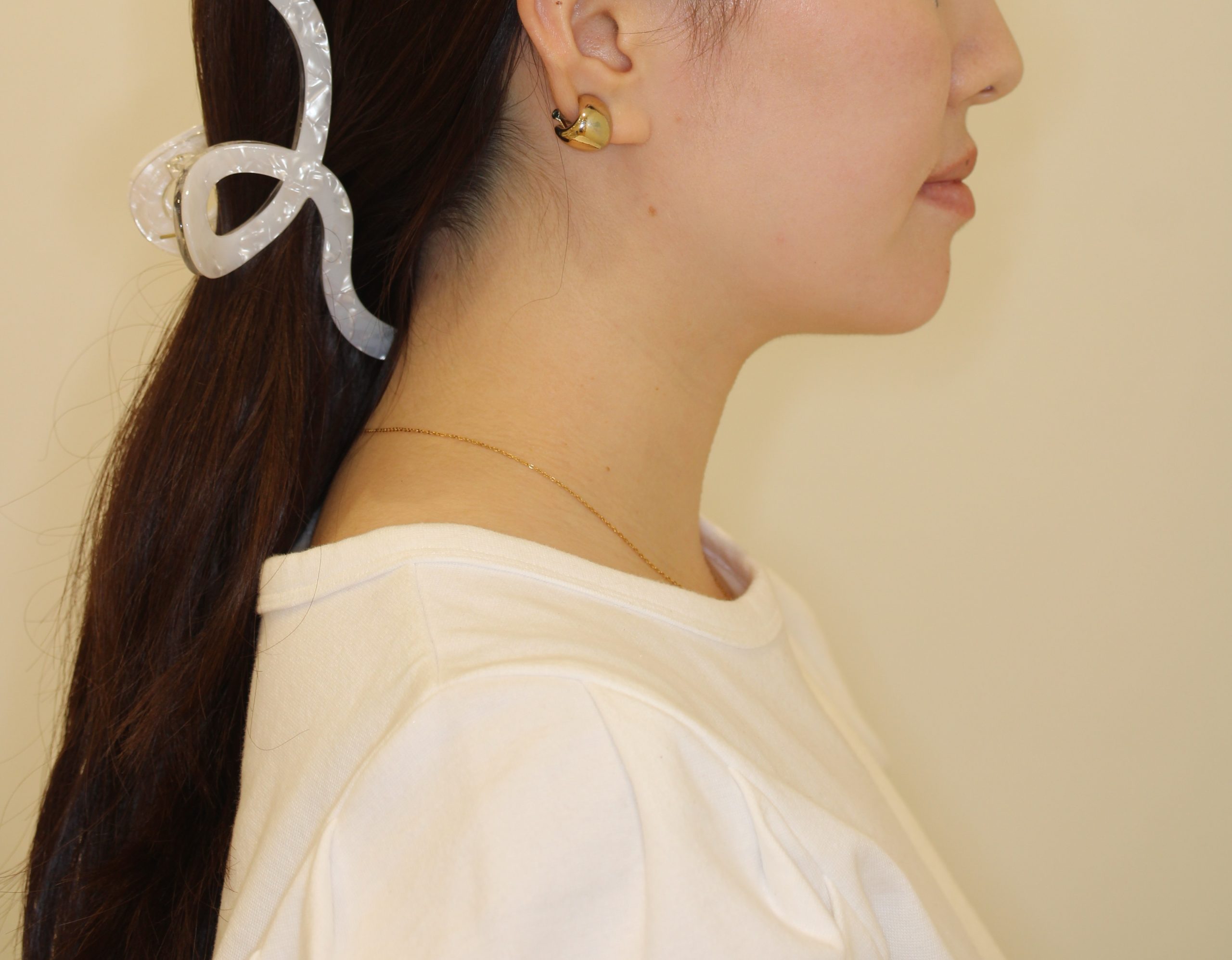 Eラインを整えたい₋ハーフリンガルの症例