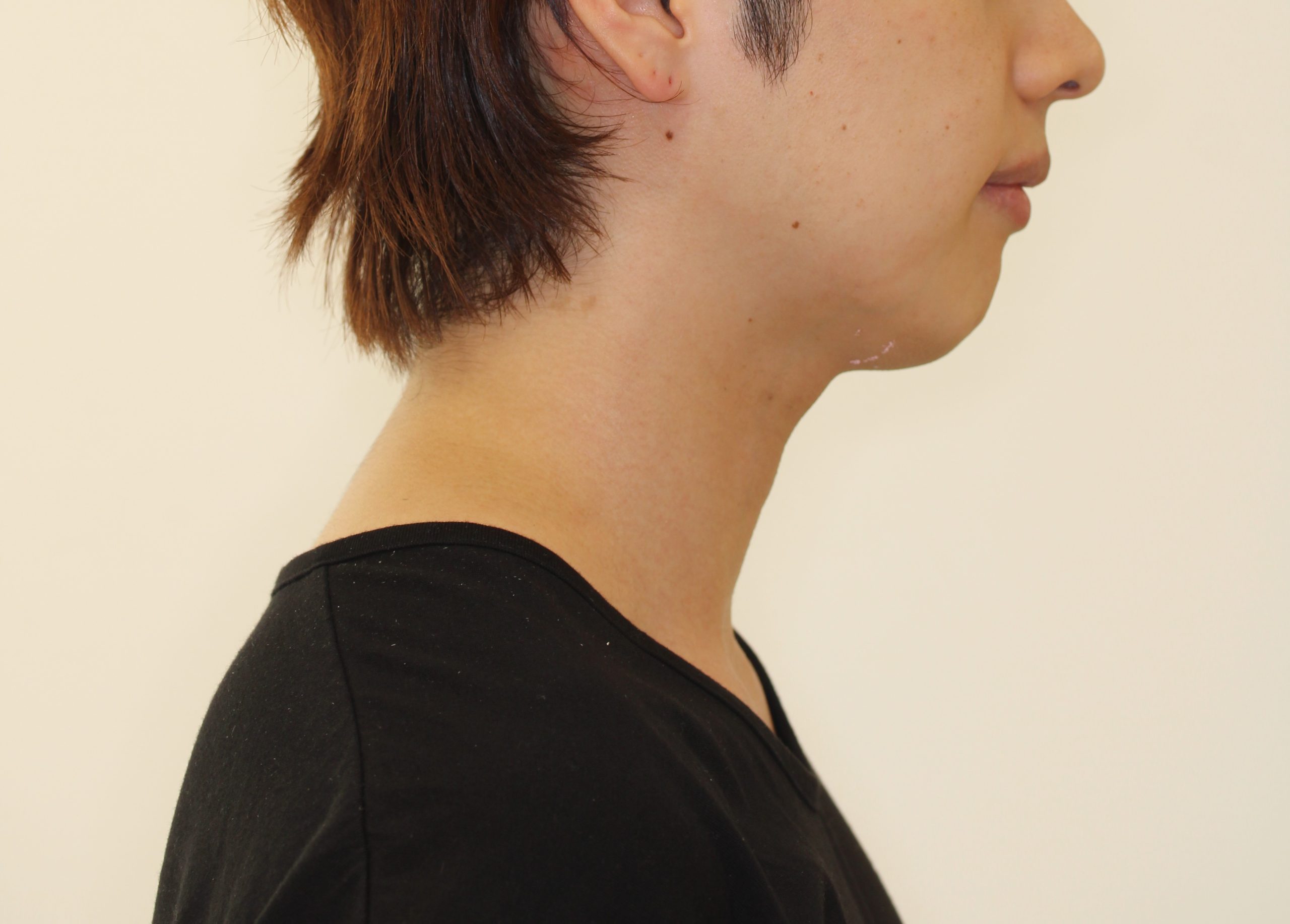 Eラインを整えたい