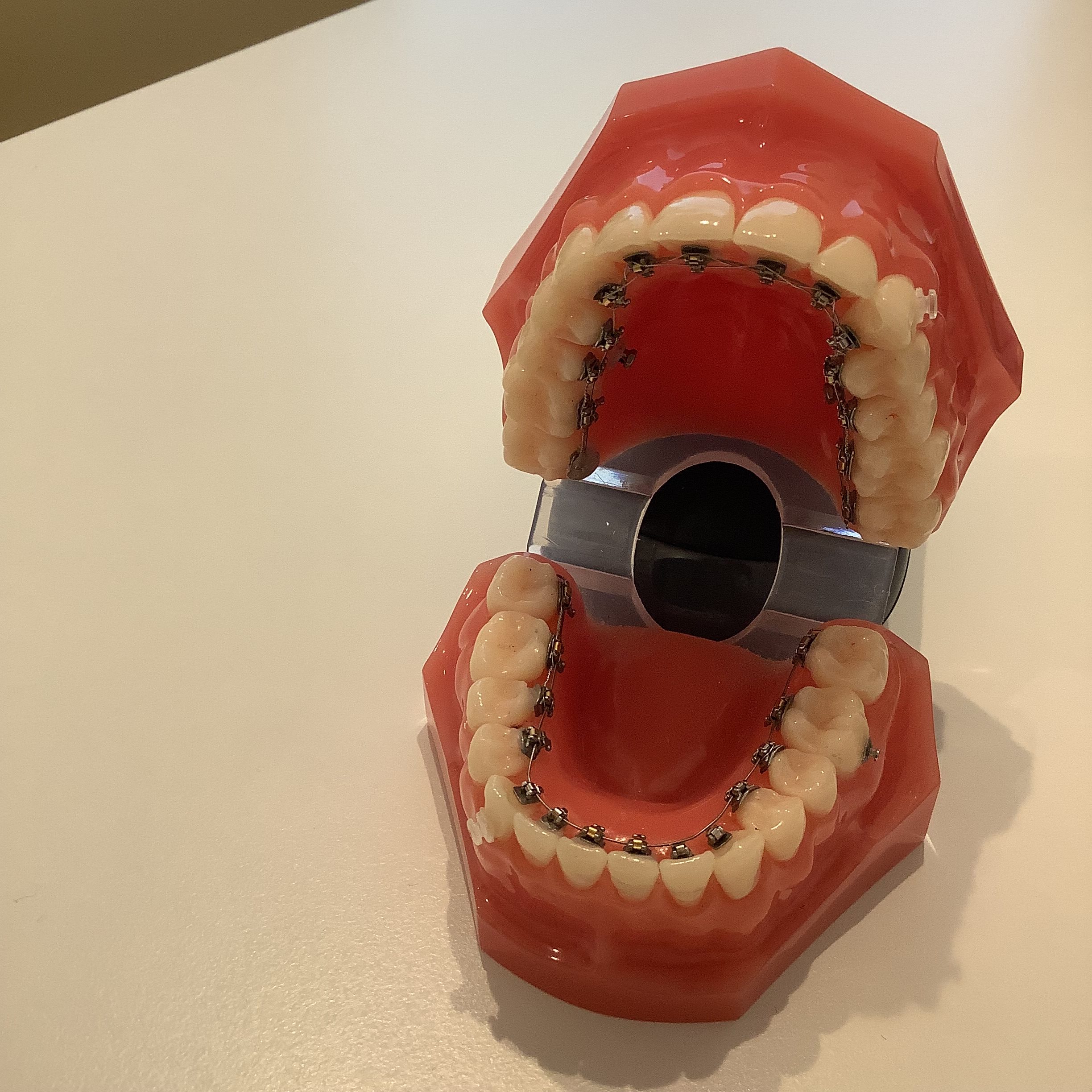 裏側矯正　リンガル矯正　矯正装置滑舌