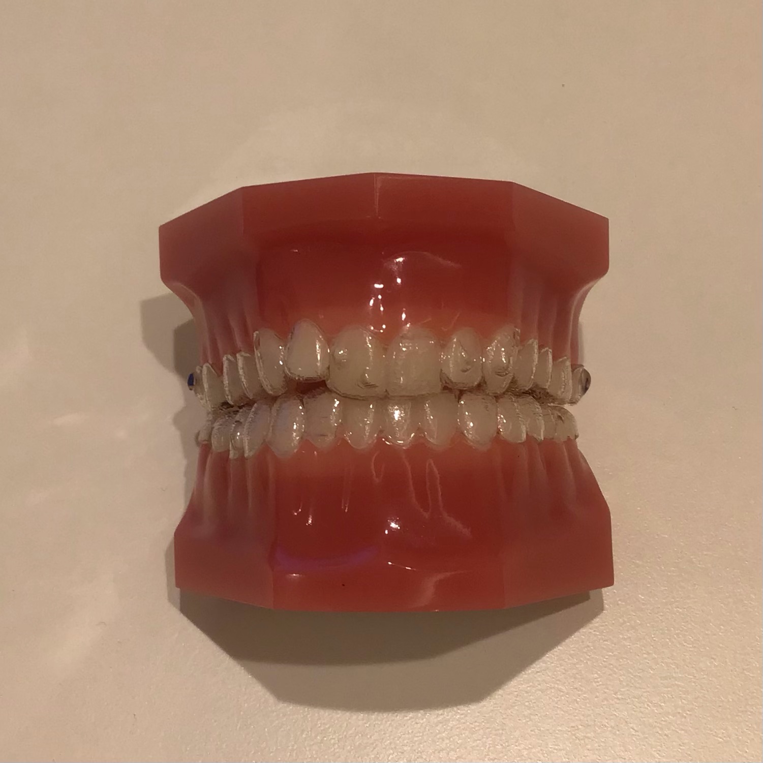 マウスピース矯正 mp 口内炎