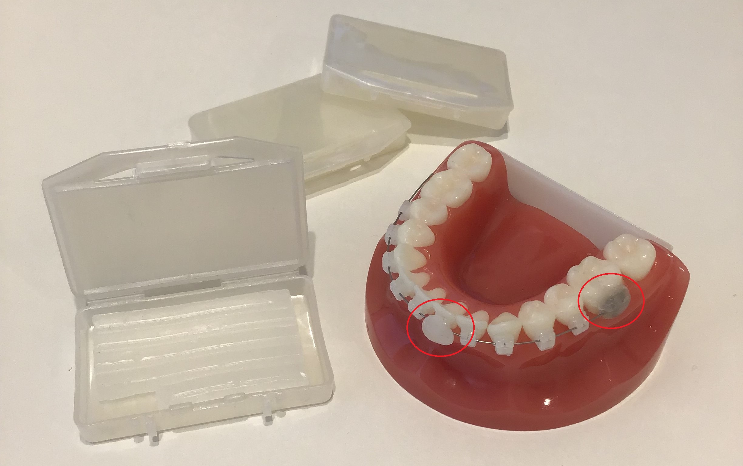 矯正用ワックス 保護剤
口内炎