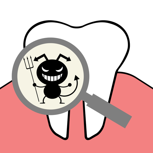 矯正中 虫歯 なりやすい