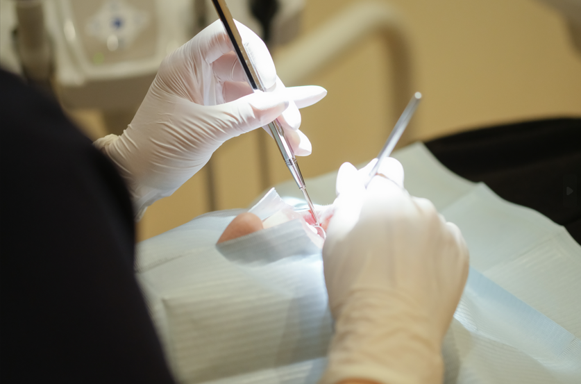 矯正装置　外す　歯列矯正