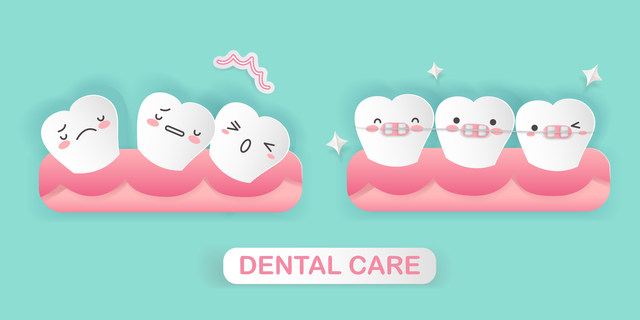 歯列矯正　変化　がたつき