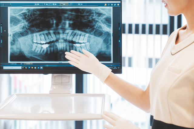 デジタル矯正　矯正装置　歯列矯正